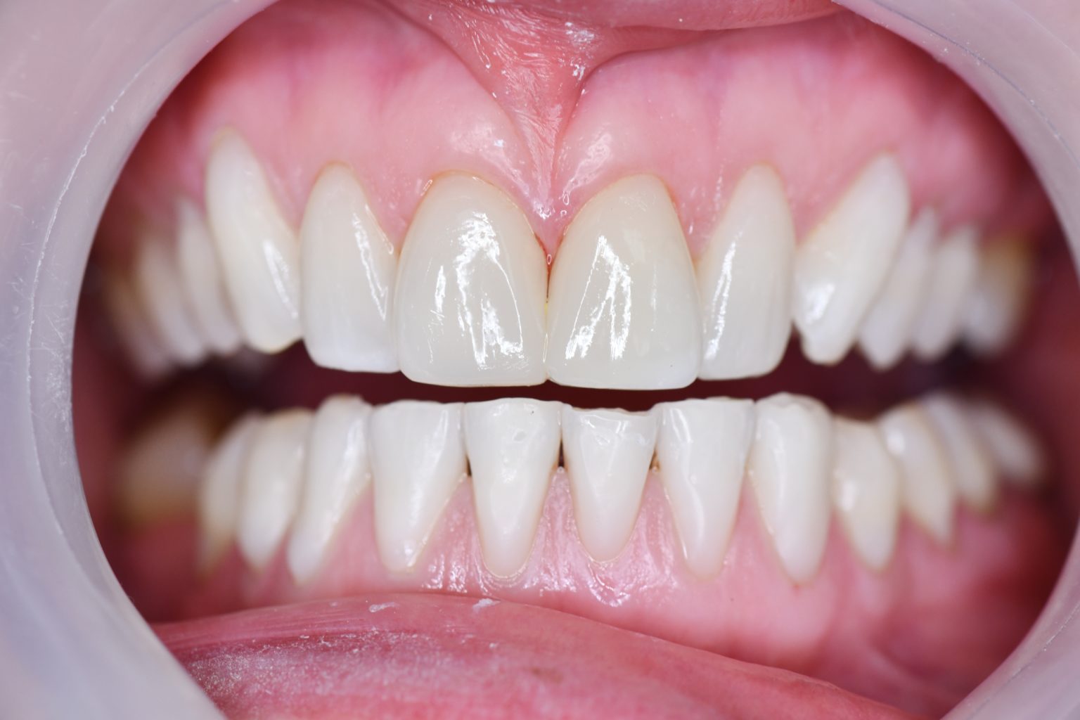 Dentist Townsville Your Smile Designers Dental Precinct