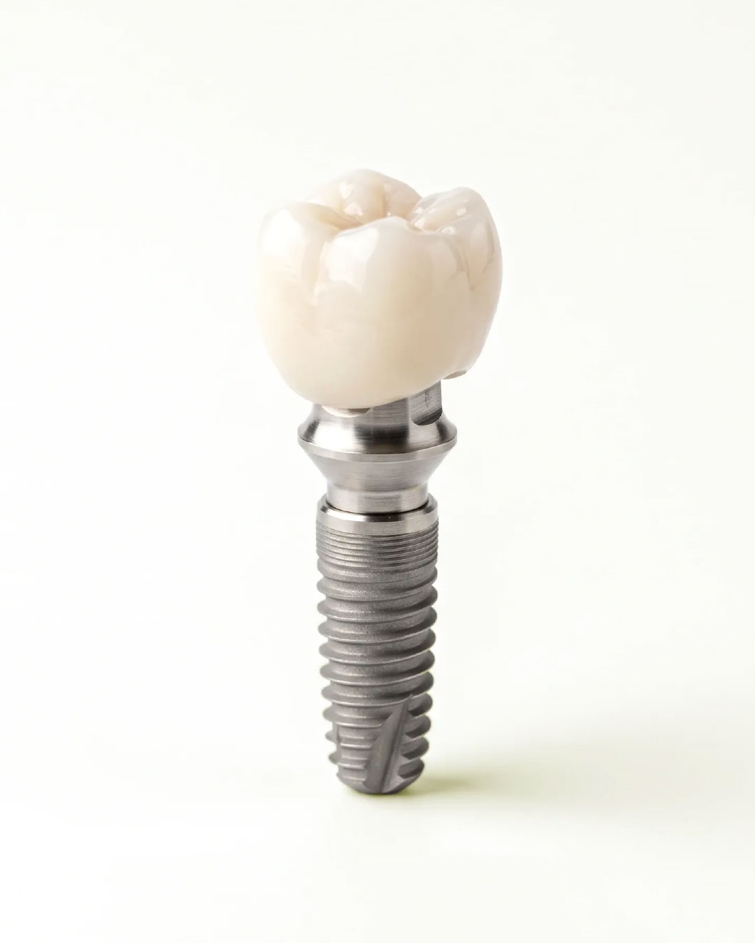 Dental-Implants-Townsville-Dentist Highly-Rated Advanced Dental Clinics Townsville